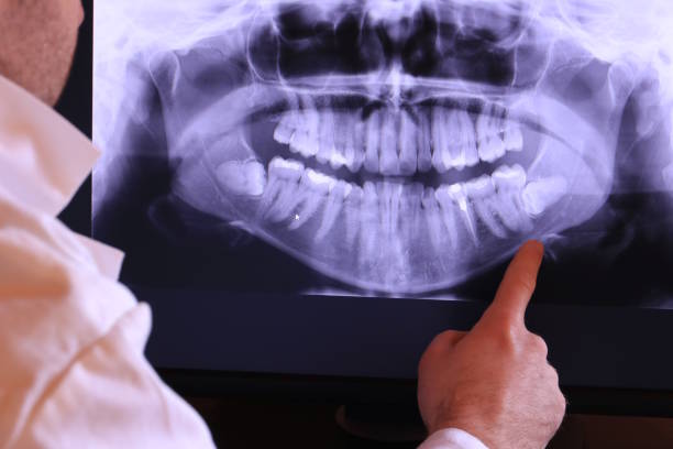 Trusted UT Emergency Dentist Experts