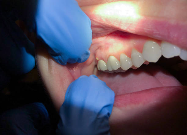 Best Emergency Treatment for Toothache in Richmond, UT